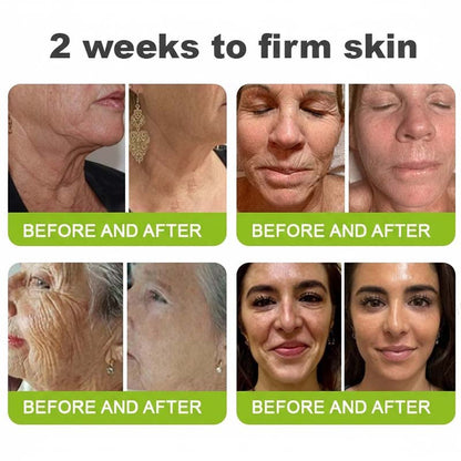 Final 3 Hours: 70%OFF🔥Peptide / Botulinum-like peptide / Line-smoothing peptide & Vita-A Retinol Shot Wrinkle-Lift Tightening cream✨
