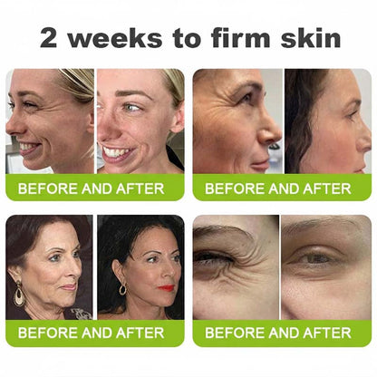 Final 3 Hours: 70%OFF🔥Peptide / Botulinum-like peptide / Line-smoothing peptide & Vita-A Retinol Shot Wrinkle-Lift Tightening cream✨