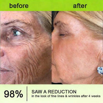 Final 3 Hours: 70%OFF🔥Peptide / Botulinum-like peptide / Line-smoothing peptide & Vita-A Retinol Shot Wrinkle-Lift Tightening cream✨