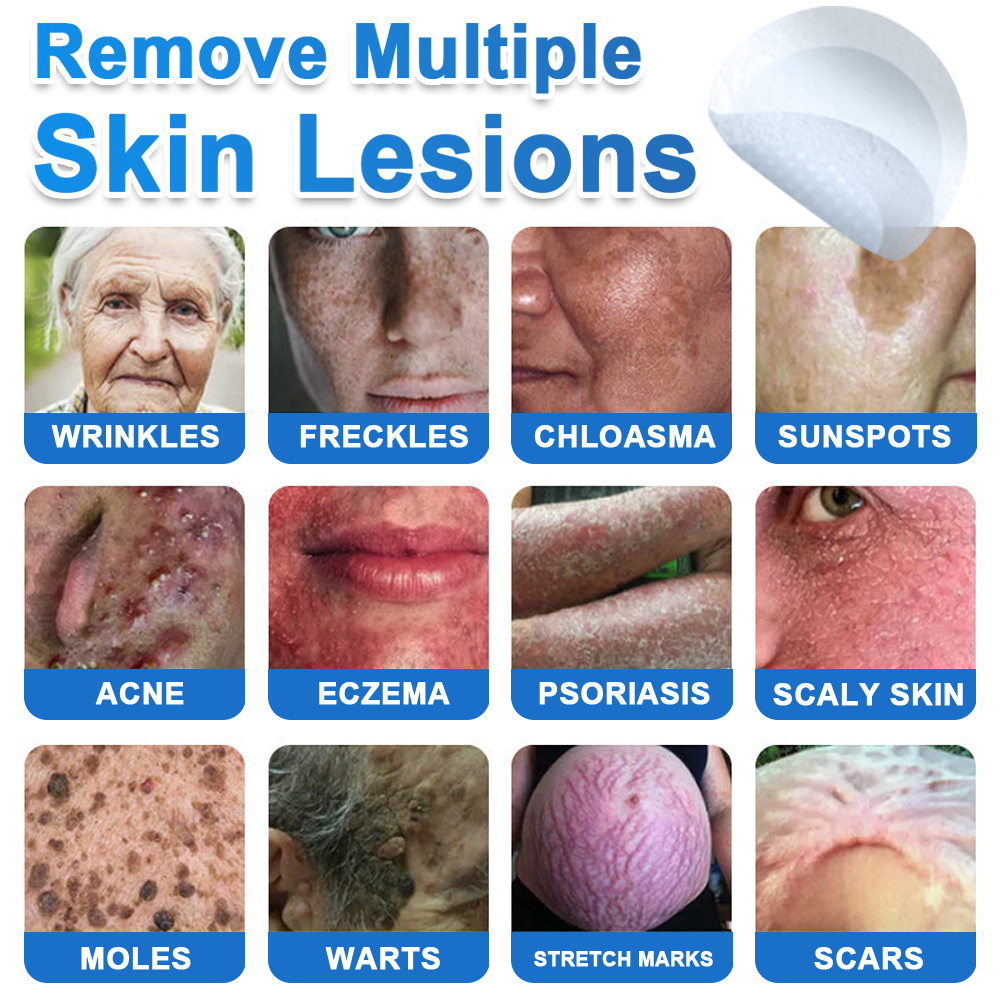 ✅ 2-in-1 Microneedle & Hydrocolloid Patch | Raised Moles,Acne,  Flat Warts & Skin Tags Remover | Improves Wrinkles, Scars & Blemishes | Invisible Pimple Patches for Face & Body