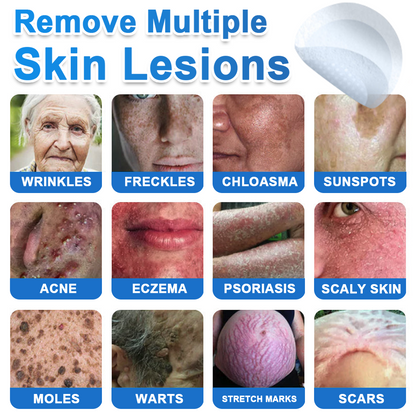 ✅ 2-in-1 Microneedle & Hydrocolloid Patch | Raised Moles,Acne,  Flat Warts & Skin Tags Remover | Improves Wrinkles, Scars & Blemishes | Invisible Pimple Patches for Face & Body