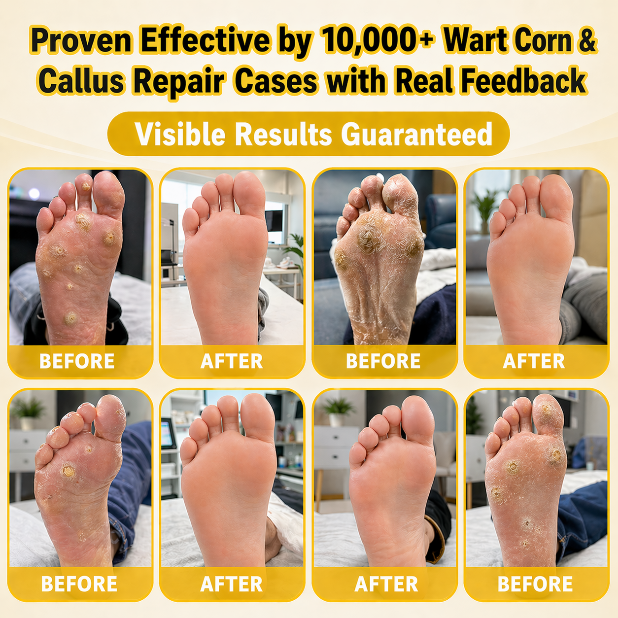 KLENIMORE-Smooth Step Bee Poison Foot Renewal Cream