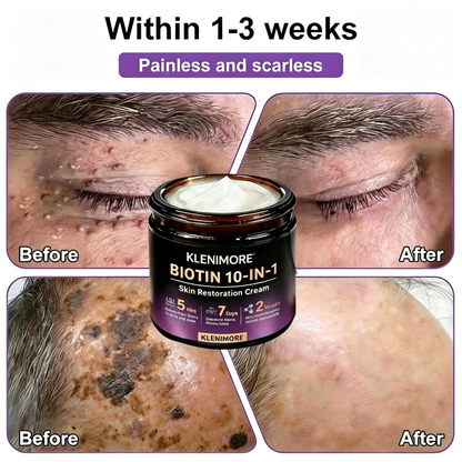Made and Shipped from USA ✨KLENIMORE™ Biotin 10-in-1 Skin Restoration Cream 🍀