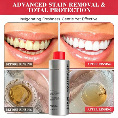 Brushing Isn’t Enough? Remove Hidden Stains & Buildup for a Brighter, Cleaner Smile