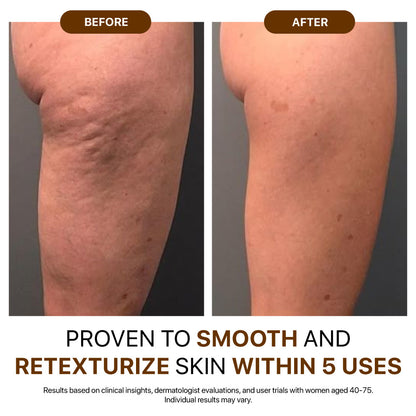 Tired of Crepey, Dry, or Sagging Skin That Moisturizers Can’t Fix? Get Visibly Firmer, Smoother Skin in 5 Uses