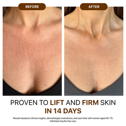 Tired of Crepey, Dry, or Sagging Skin That Moisturizers Can’t Fix? Get Visibly Firmer, Smoother Skin in 5 Uses