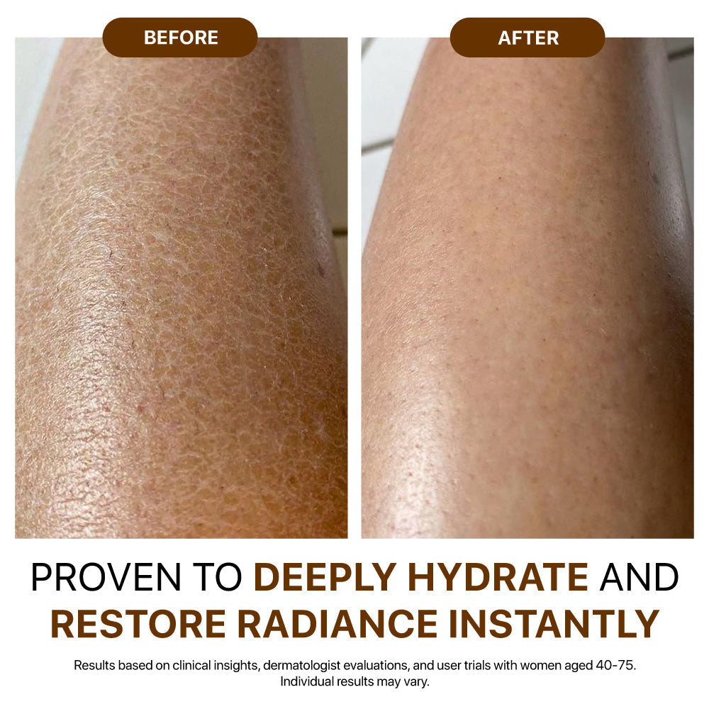 Tired of Crepey, Dry, or Sagging Skin That Moisturizers Can’t Fix? Get Visibly Firmer, Smoother Skin in 5 Uses